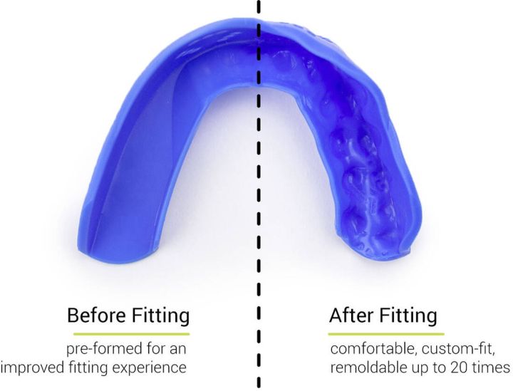 Chránič zubov Sisu 3D Intense Red